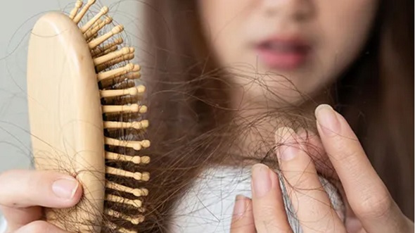 Rambut Rontok? Mungkin Tubuh Anda Kekurangan Besi!