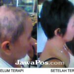 Apakah Rambut Rontok Bisa Tumbuh Lebih Tebal dengan Perawatan Herbal?