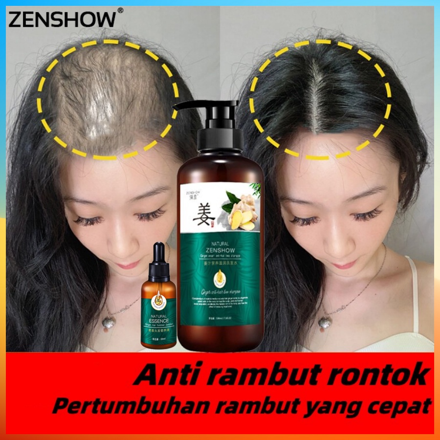 Apakah Omega-6 Dapat Membantu Meningkatkan Pertumbuhan Rambut?