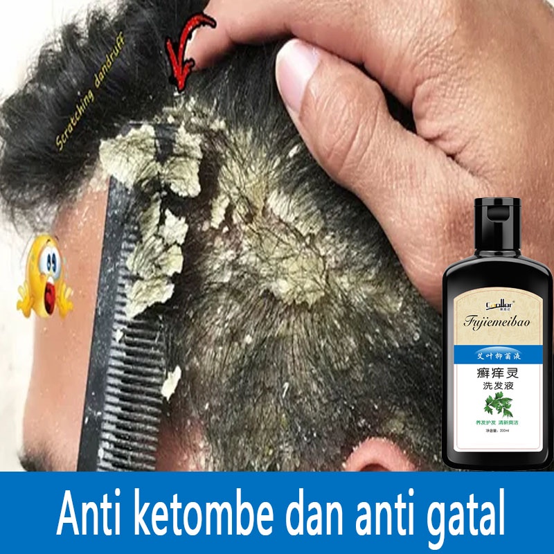 Taklukkan Ketombe dengan Shampoo Anti Ketombe: Panduan Lengkap untuk Rambut Sehat Berkilau