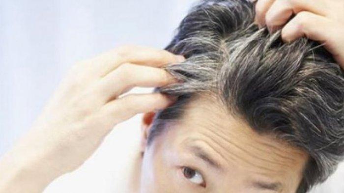 Rambut Beruban di Usia Muda: Lebih dari Sekedar Penuaan?