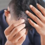 Apakah Vitamin Rambut Efektif untuk Mengatasi Rambut Rontok?