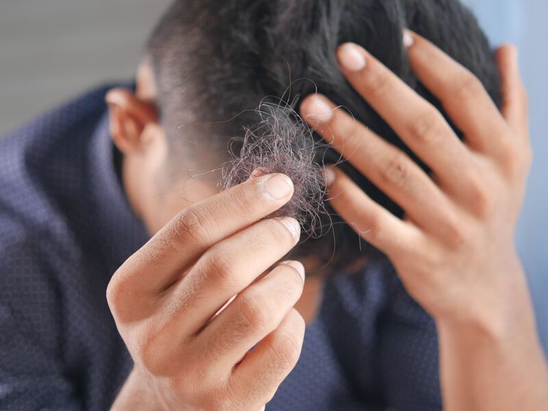 Apakah Vitamin Rambut Efektif untuk Mengatasi Rambut Rontok?