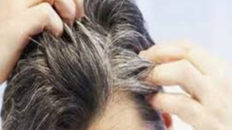 Rambut Beruban: Takdir atau Pilihan? Memahami Penyebab, Solusi, dan Cara Merawatnya