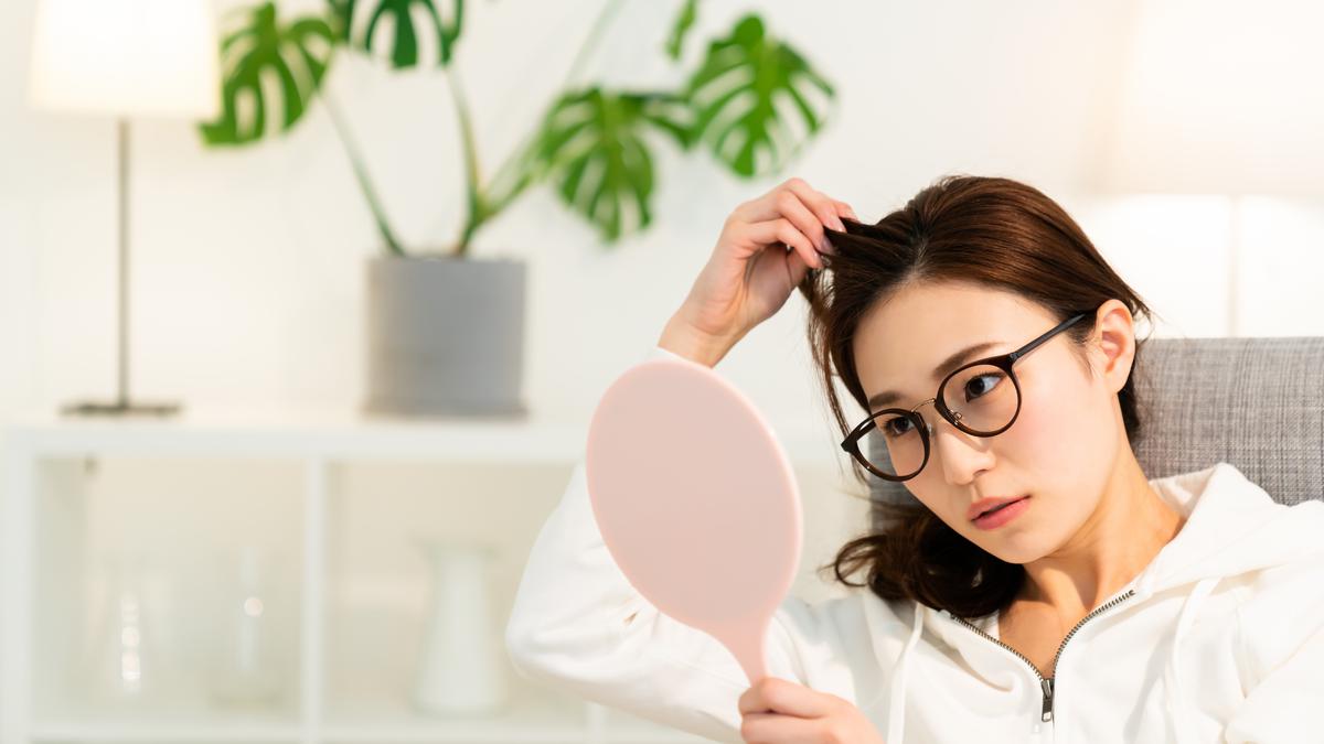 Rambut Berketombe Kronis? Jangan Panik, Coba Solusi Alami Ini!