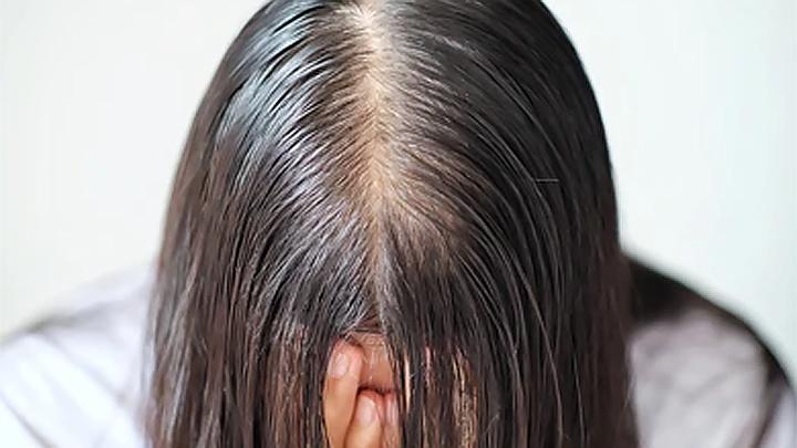 Rahasia Rambut Sehat dan Berkilau: Peran Penting Protein dalam Pertumbuhan Rambut