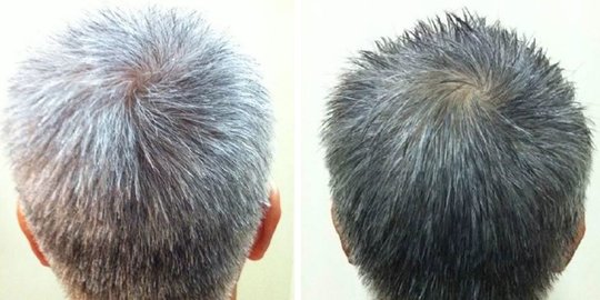 Mengatasi Rambut Putih di Usia Muda: Tips dan Solusi Terbaik