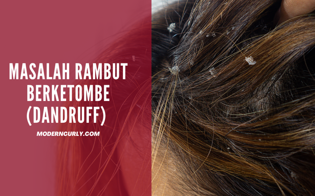 Rambut Berketombe Kronis? Jangan Panik, Coba Solusi Alami Ini!