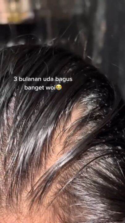 Rambut Bercabang Hilang Permanen dengan Treatment Ini: Ucapkan Selamat Tinggal pada Rambut Rusak!