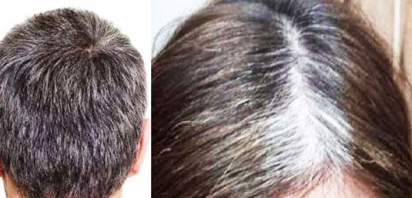 Mengatasi Rambut Putih di Usia Muda: Tips dan Solusi Terbaik