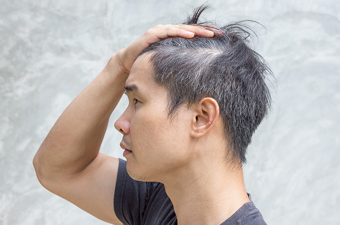 Rambut Beruban di Usia Muda? Jangan Khawatir, Ini Penyebab dan Solusinya!