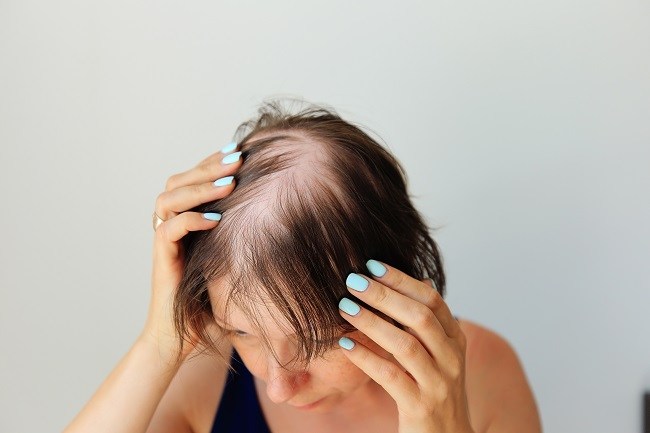 10 Produk Rambut Alami yang Ampuh Mengatasi Rambut Rusak