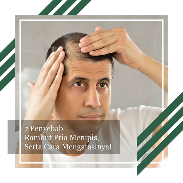 Rambut Anda Tipis Karena Faktor Genetik? Ini Solusinya!