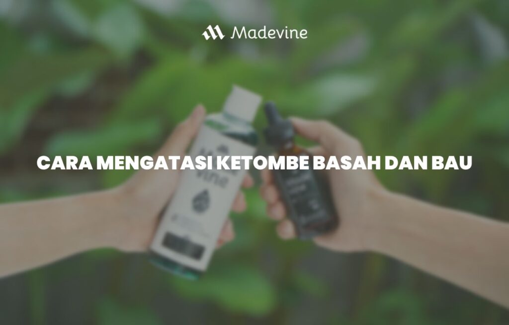 Apa Itu Ketombe Basah dan Bagaimana Cara Mengatasinya?