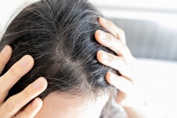 Cara Menutrisi Rambut Kering dengan Makanan Sehat