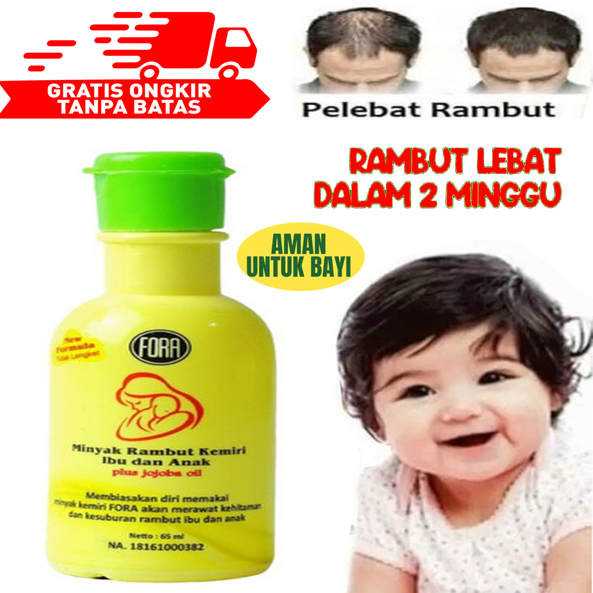 5 Minyak Rambut Terbaik untuk Rambut Kering dan Rusak