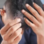 Cara Mengatasi Rambut Rontok Secara Alami Tanpa Obat