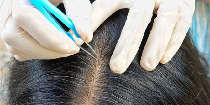 Mengatasi Rambut Beruban Secara Alami Tanpa Pewarna Kimia