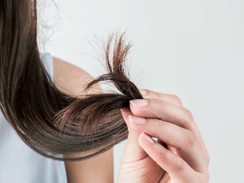 Rambut Anda Berketombe Parah? Coba 5 Tips Ini!