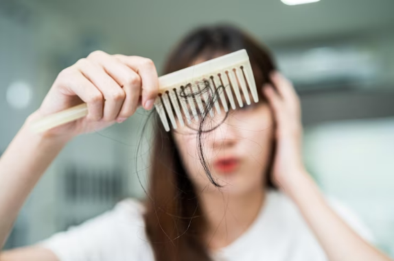 Penyebab Rambut Anda Cepat Rontok Saat Menyisir dan Cara Mencegahnya