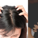 Rambut Anda Selalu Lepek? Coba 5 Solusi Praktis Ini!