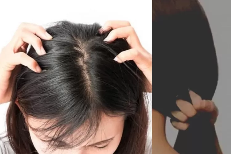 Rambut Anda Selalu Lepek? Coba 5 Solusi Praktis Ini!