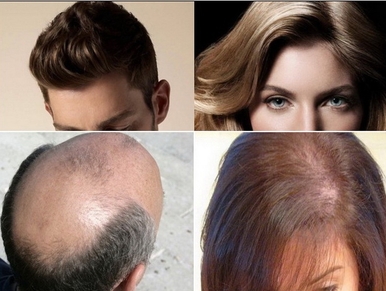 Rahasia Rambut Sehat, Kuat, dan Berkilau: Ucapkan Selamat Tinggal pada Rambut Patah dan Kusam!