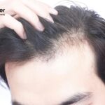 Cara Mengatasi Rambut Anda yang Selalu Lepek Setelah Keramas