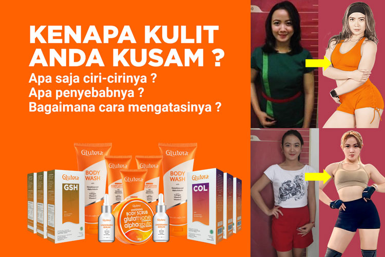 Rambut Anda Kusam? Begini Cara Mengatasinya dengan Produk Alami!