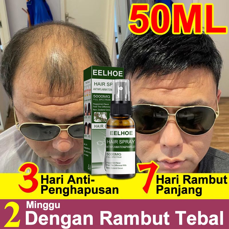 Hair Oil Terbaik untuk Setiap Jenis Rambut: Panduan Lengkap