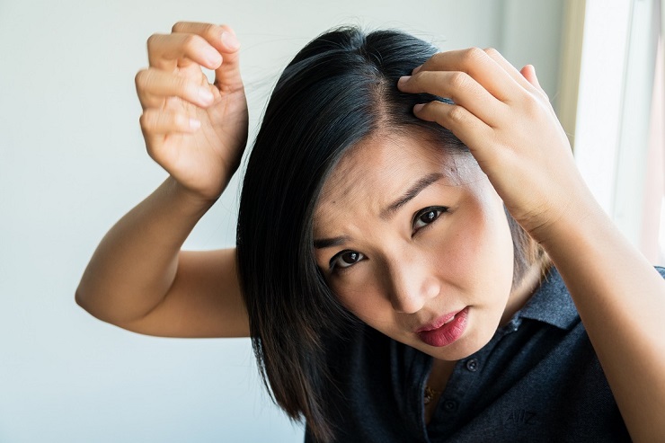 Mengapa Rambut Saya Selalu Rontok Setelah Keramas?