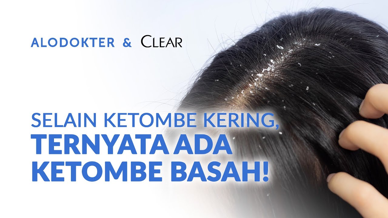 Apa Itu Ketombe Basah dan Bagaimana Cara Mengatasinya?