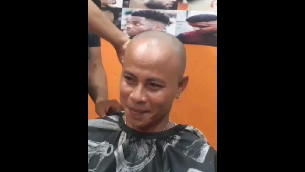 Rambut Anda Tidak Mudah Tumbuh? Simak Solusi Efektif Ini