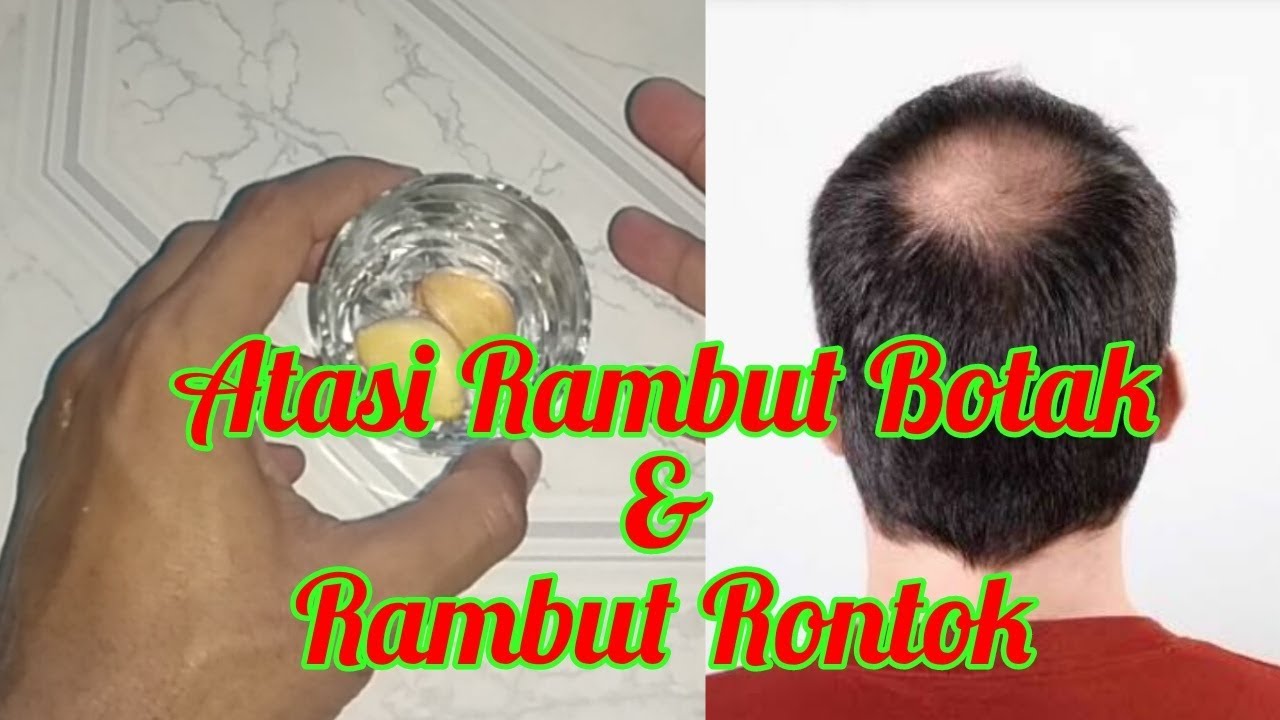 Atasi Rambut Rontok dari Akarnya: Panduan Lengkap 2024