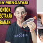 Cara Mengatasi Rambut Rontok Akibat Perubahan Hormon Setelah Berhenti KB