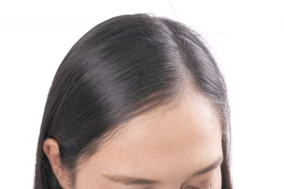 Cara Mencegah Rambut Beruban Meski Usia Masih Muda