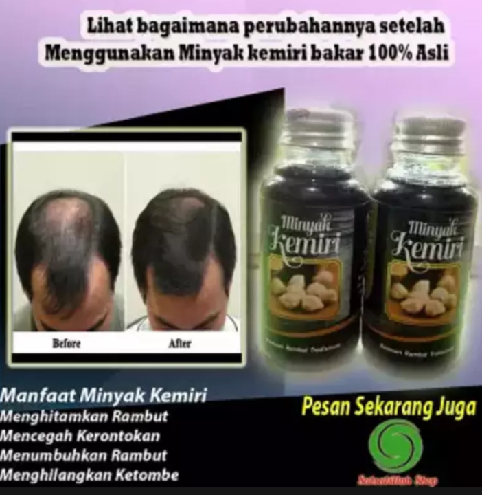 Masker Rambut Minyak Kemiri: Rahasia Rambut Tebal dan Kuat Secara Alami