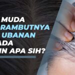 Penyebab Rambut Berminyak di Bagian Depan dan Cara Mengatasinya